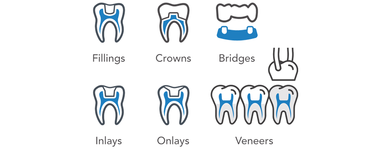 Restorative Dentistry infographic showing Fillings, Crowns, Bridges, Inlays, Onlays and Veneers.